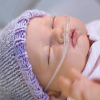 size-1-nasal-ram-cannula-green
