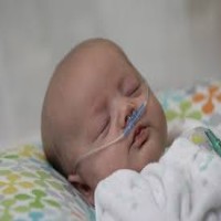 size-2-nasal-ram-cannula-blue-2000-3000-gms