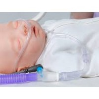 size-3-nasal-ram-cannula-orange-3000-4000-gms