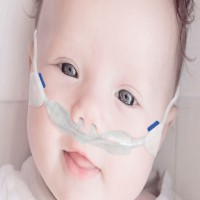 size-4-nasal-ram-cannula-yellow-4000-6000-gms