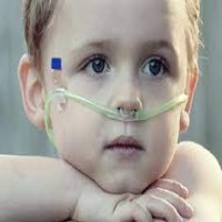 size-6-nasal-ram-cannula-purple-6000-gms