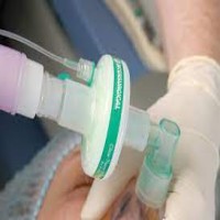 HMEF/ Bacterial Filter