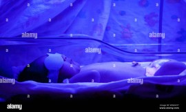 Phototherapy Consumables